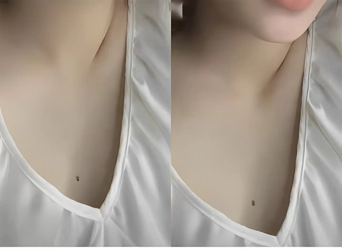 width=1436