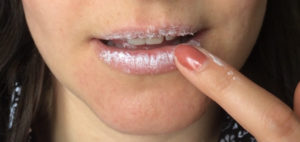 width=551