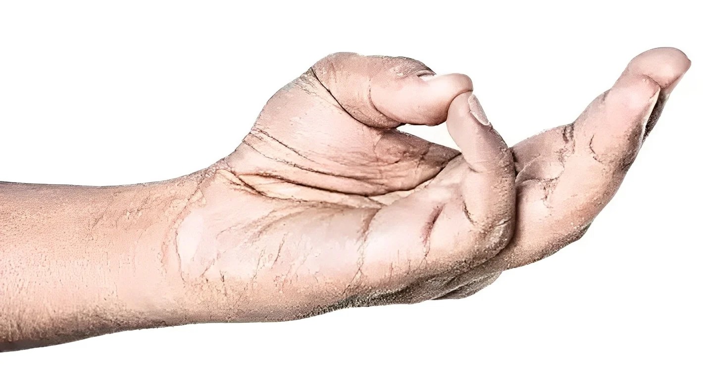 width=1420