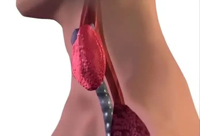 width=696