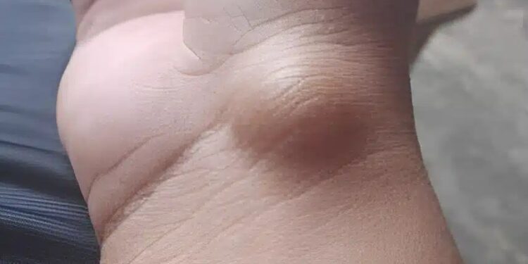 width=750