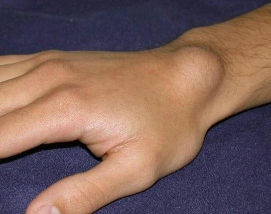 width=540