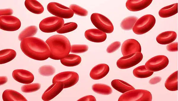 anemia