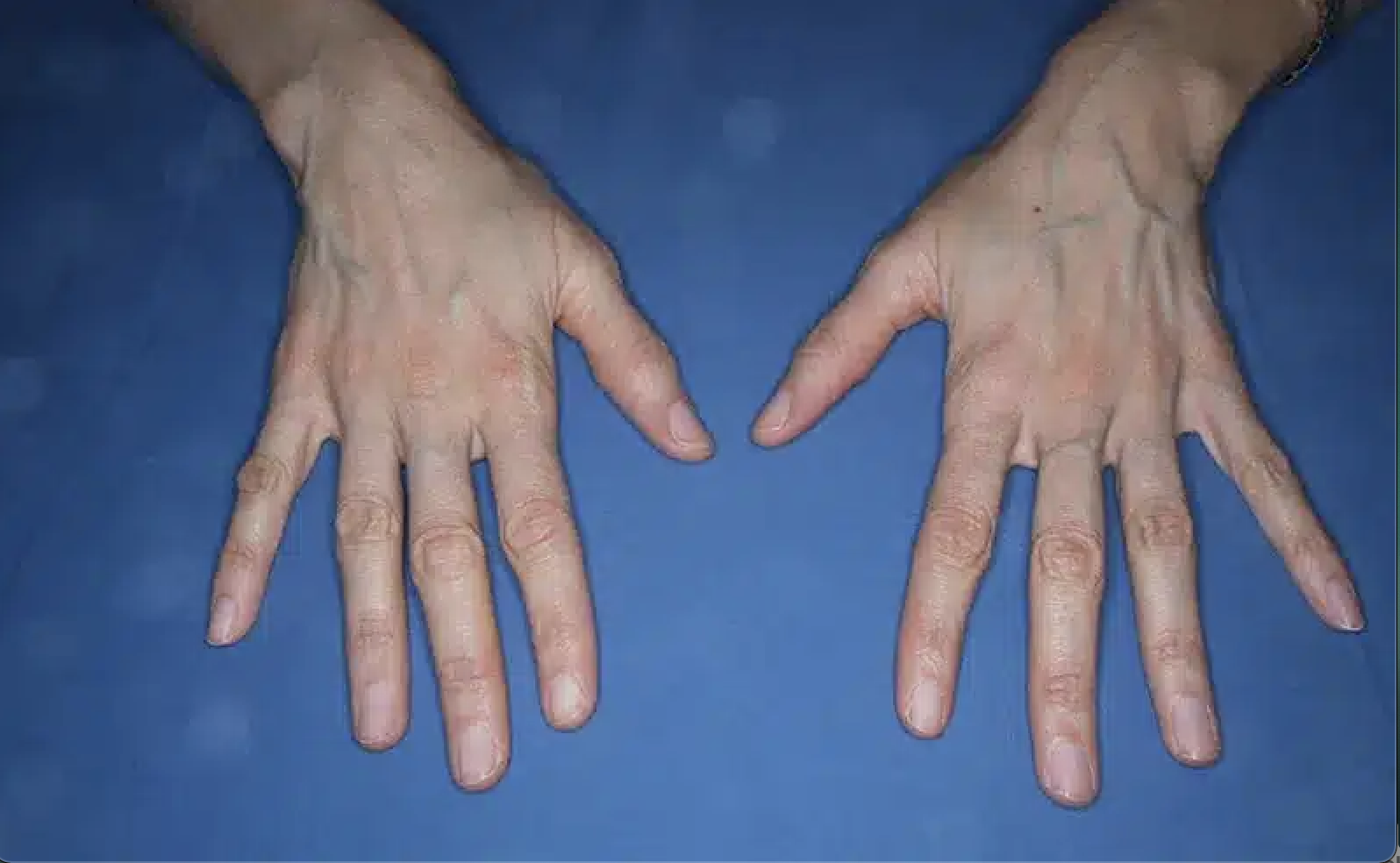 width=1596