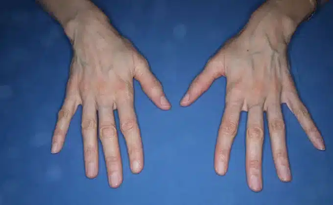 width=680