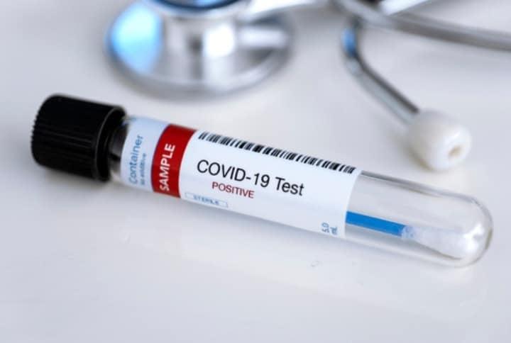 diagnostika test kai covid 19