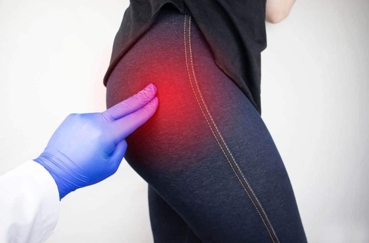 hip bursitis trochanteric bursitis pain 1600x1054 1