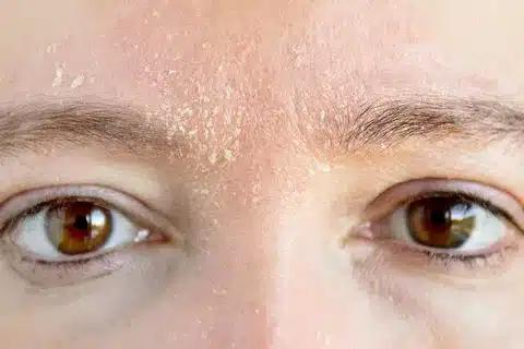 dry