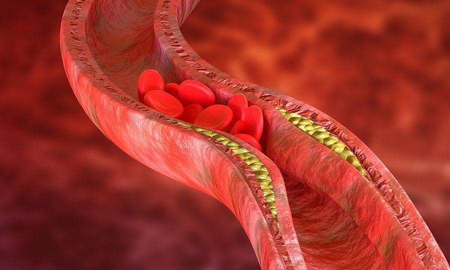 arteries