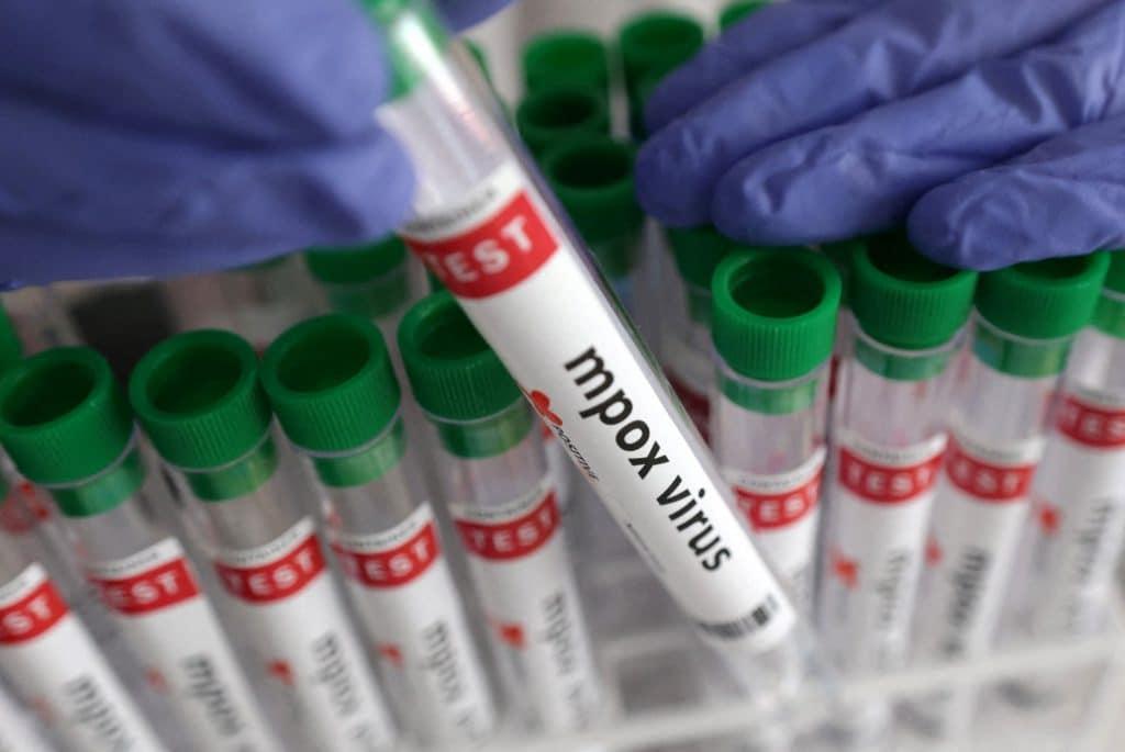 Επιφυλακή στην Ευρώπη - H επανεμφάνιση γνωστού ιού που ανησυχεί τους επιστήμονες 1 2024 08 23t094543z 531302439 rc2pj9a61zzy rtrmadp 5 health mpox germany vaccine 1024x685 1