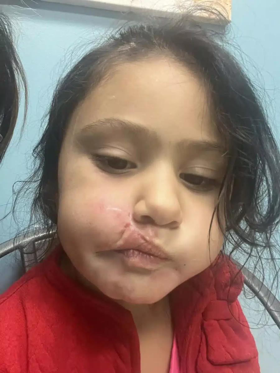 0 four year old girl mauled by pit bull as mum desperately fought to save her