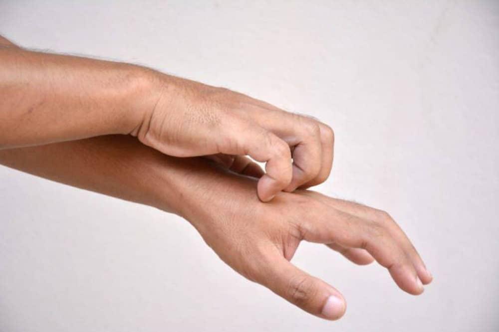 Φαγούρα στο σώμα: Πότε εμφανίζεται και τι σημαίνει για την υγεία μας 5 20201129 5fc359f72bee7