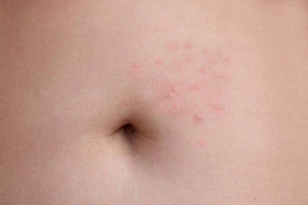 Φαγούρα στο σώμα: Πότε εμφανίζεται και τι σημαίνει για την υγεία μας 10 20201129 5fc359ffe2b01