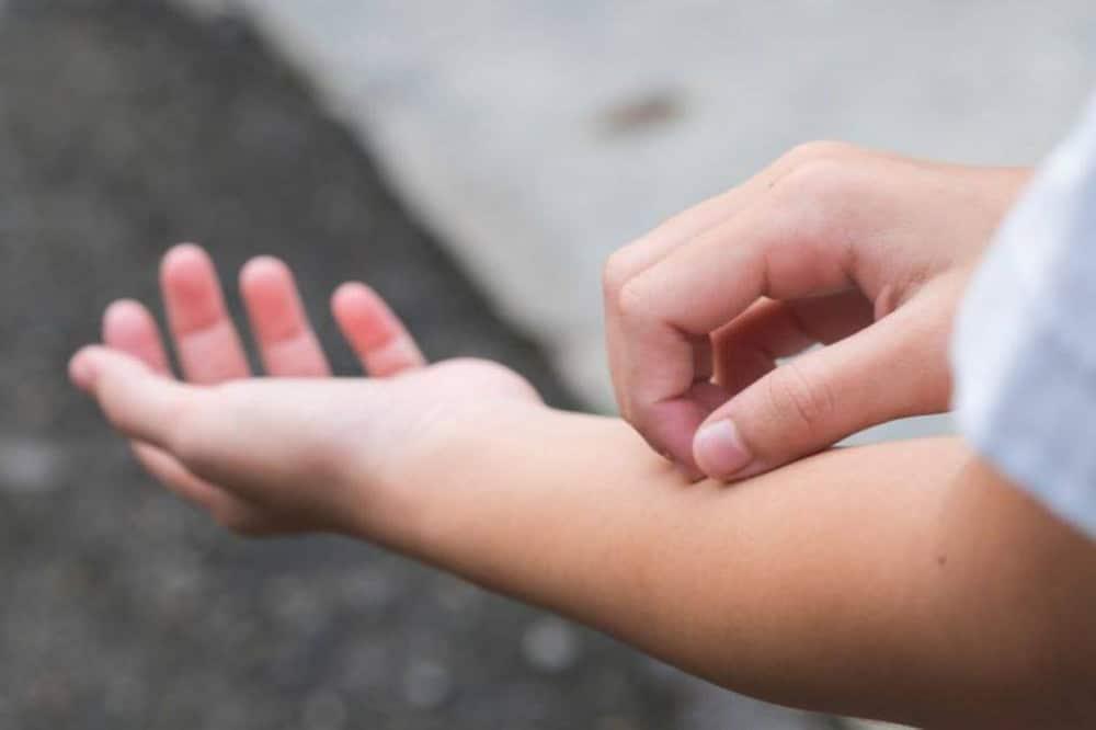 Φαγούρα στο σώμα: Πότε εμφανίζεται και τι σημαίνει για την υγεία μας 11 20201129 5fc35a016e592