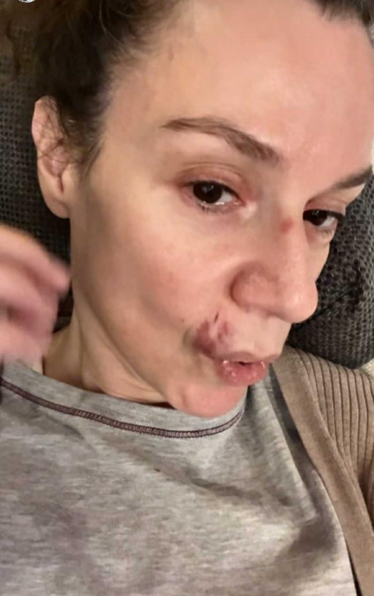 Με μαυρισμένο μάτι και με αίματα στο πρόσωπο η Πέγκυ Τρικαλιώτη 4 peggi