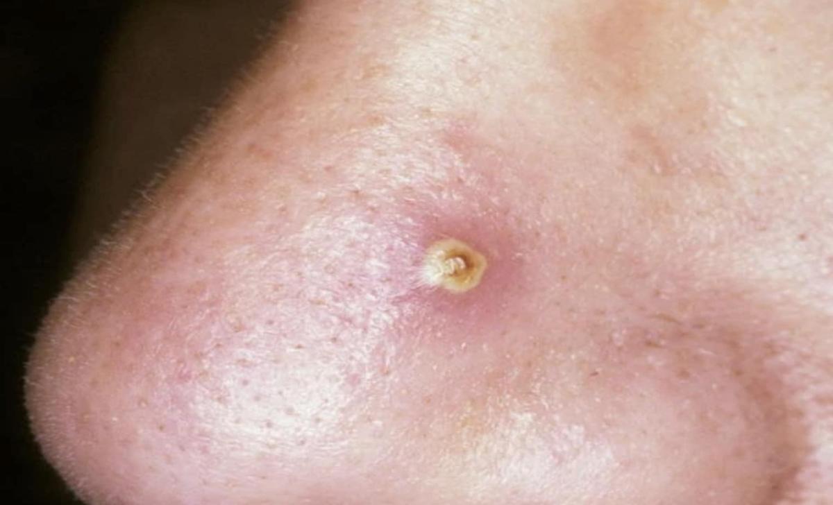 stigmiotypo othonis 2025 08 07 19.31.23