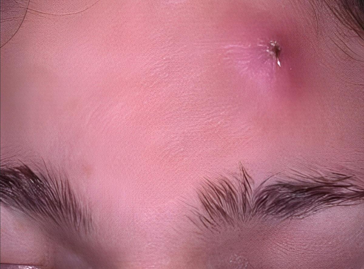 stigmiotypo othonis 2025 08 07 19.31.46