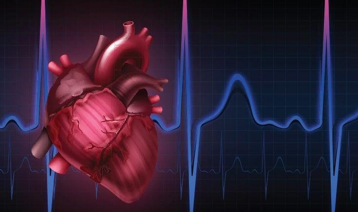 Οι γιατροί προειδοποıούν: Τα 10 «αθώα» συμπτώματα που καμία γυναίκα άνω των 40 ετών δεν πρέπει να αγνοήσει, μεγάλη προσοχń 4 kardiakes arrithmies