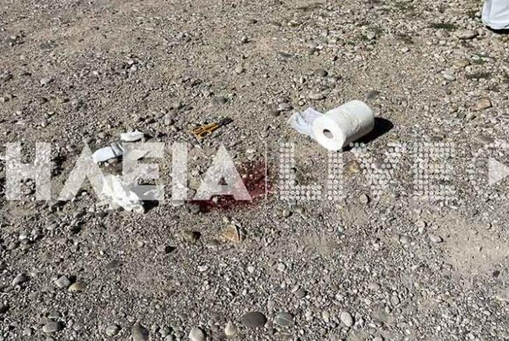 Νεκρός στη Φυλακή ο Δολοφοnος που Συγκλόνισε το πανελλήνιο 1 1 54 7