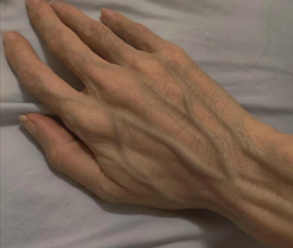 stigmiotypo othonis 2025 11 11 03.06.50