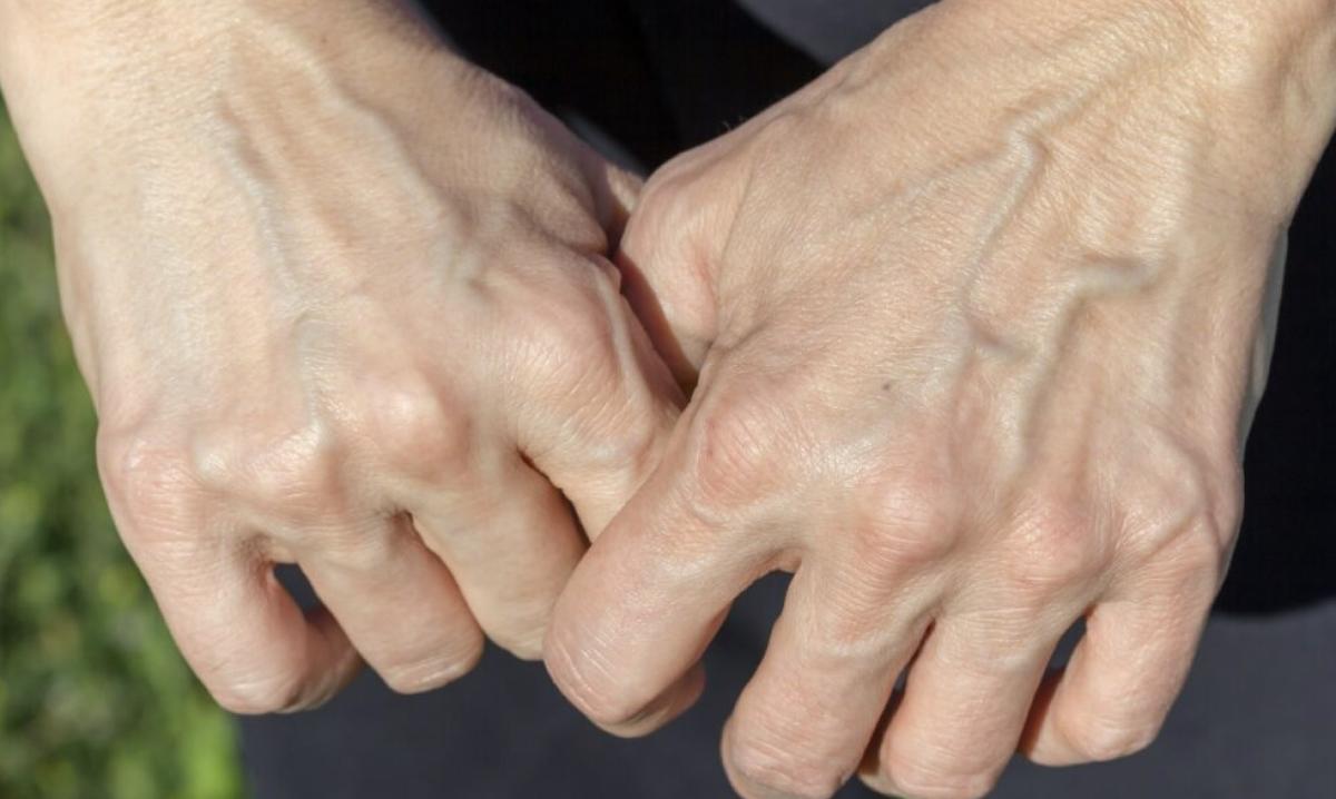 stigmiotypo othonis 2025 11 11 03.08.42