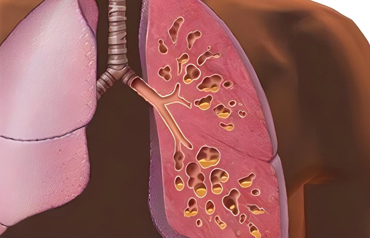 stigmiotypo othonis 2025 11 11 21.51.29