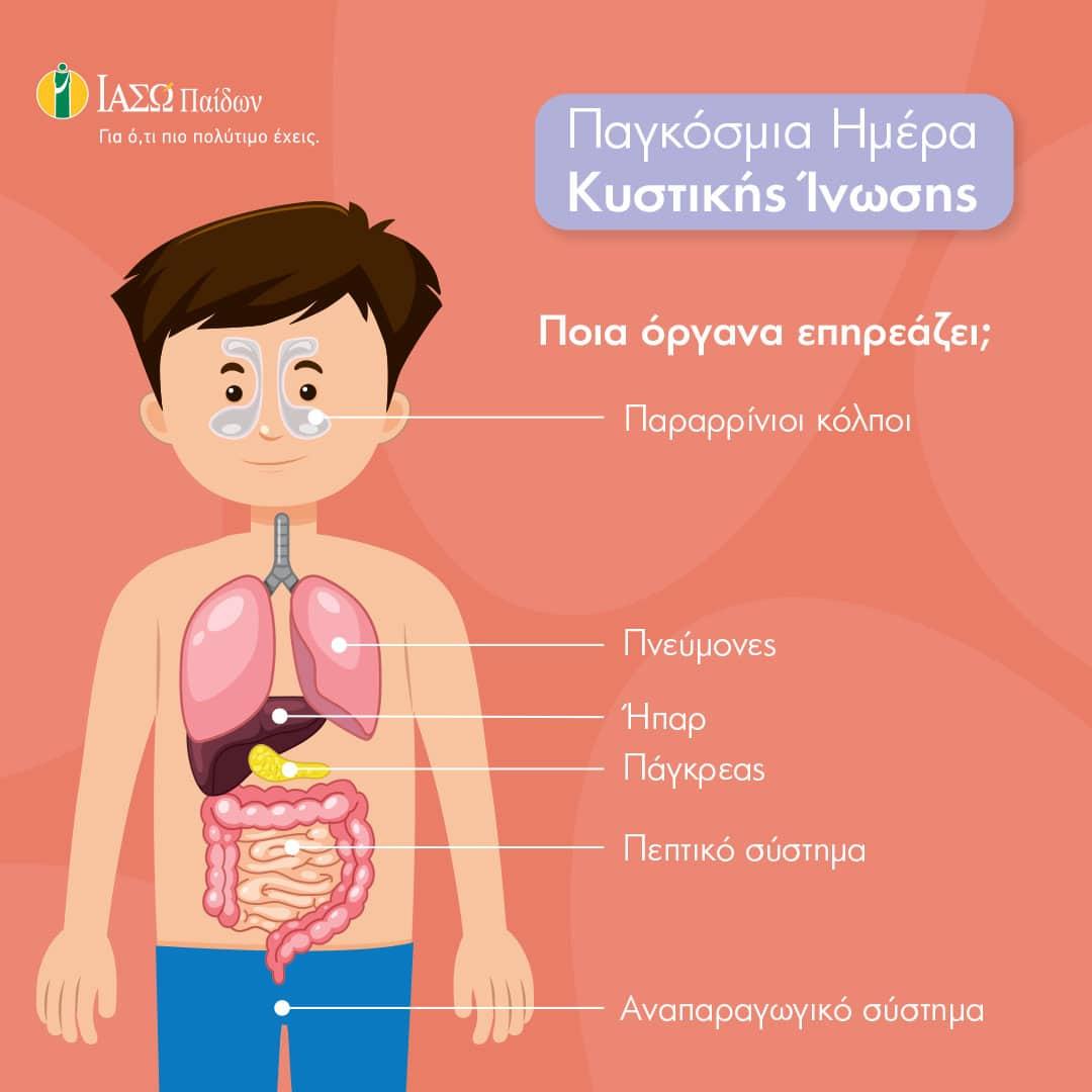 Τι είναι η Κυστική Ίνωση που πήρε τη ζωή της 27χρονη Αναστασίας Τασούλα 4 kystiki inwsi iaso