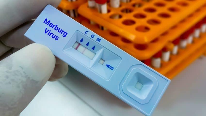 Αιθιοπία: Επιβεβαιώθηκε έξαρση του θανατηφόρου ιού Μάρμπουργκ – Επιδημιολογικές εξετάσεις σε εξέλιξη 2 ios marmpoyrgk