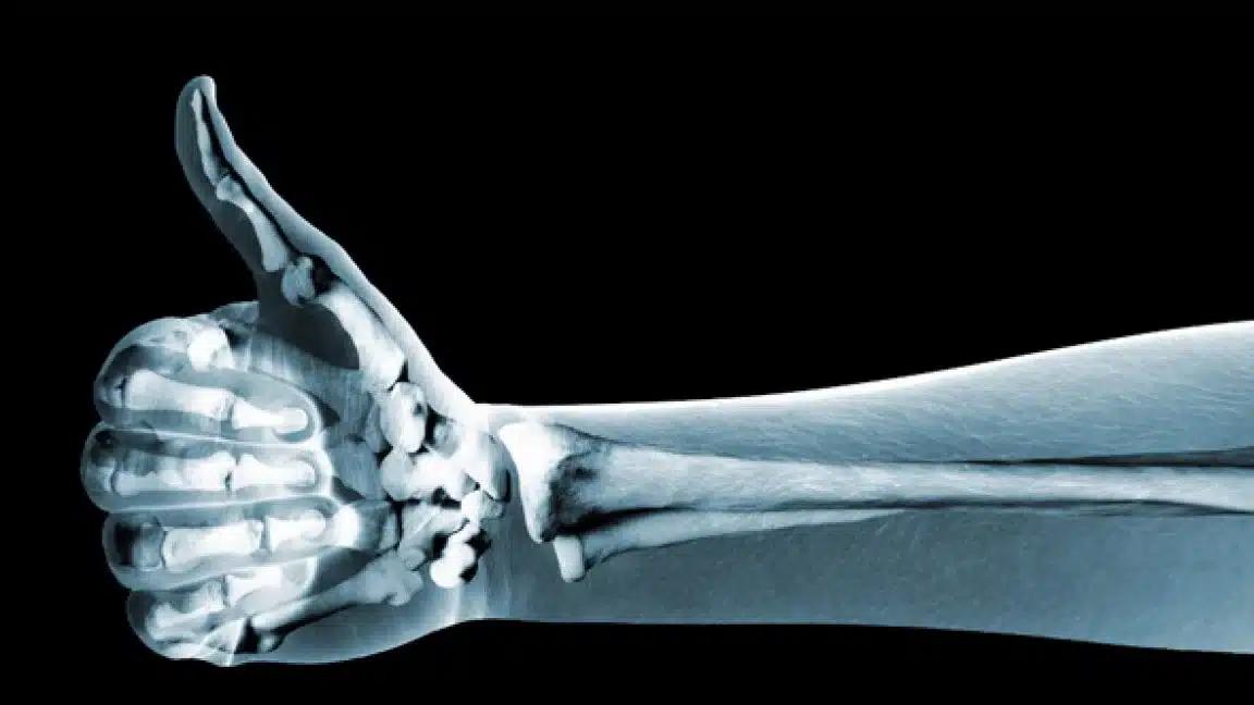 Η νούμερο 1 τροφή για γερά οστά μετά τα 50 δεν έχει καμία σχέση με γαλακτοκομικά 2 runner 20840 1152x648 1