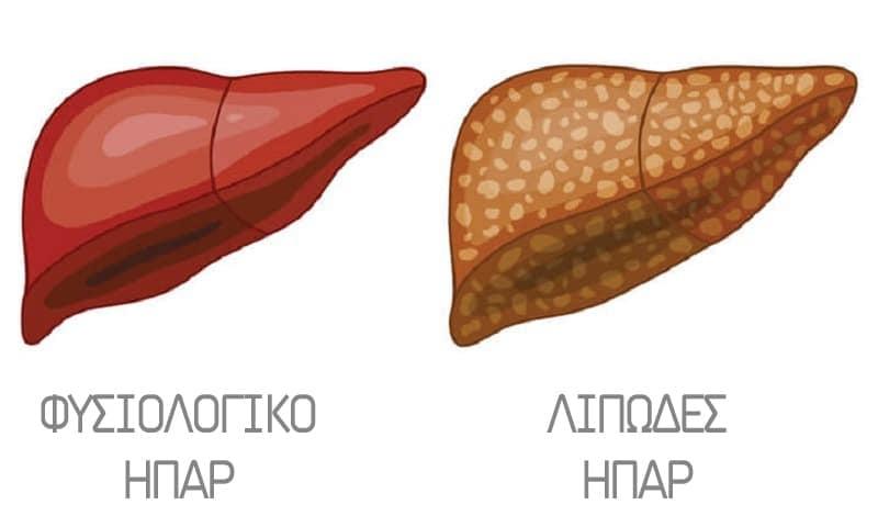 lipodis diithisi sto ipar 3
