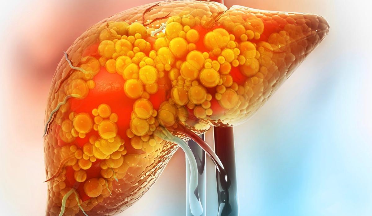 stigmiotypo othonis 2025 06 06 18.35.22