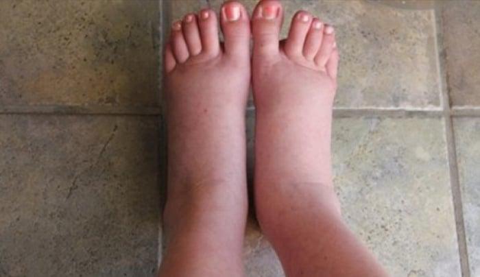 860fc6e49c82bda67fdd677611d9752e m