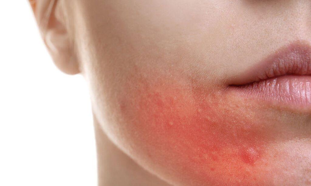 1643645903575 277752488 akmi 5