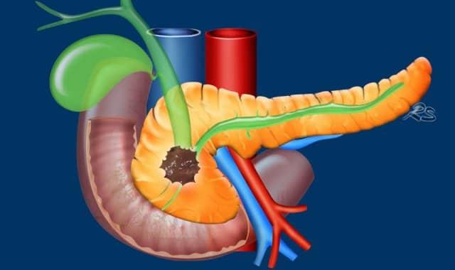 f90fb7dadd8623ba1e278afc43f95527