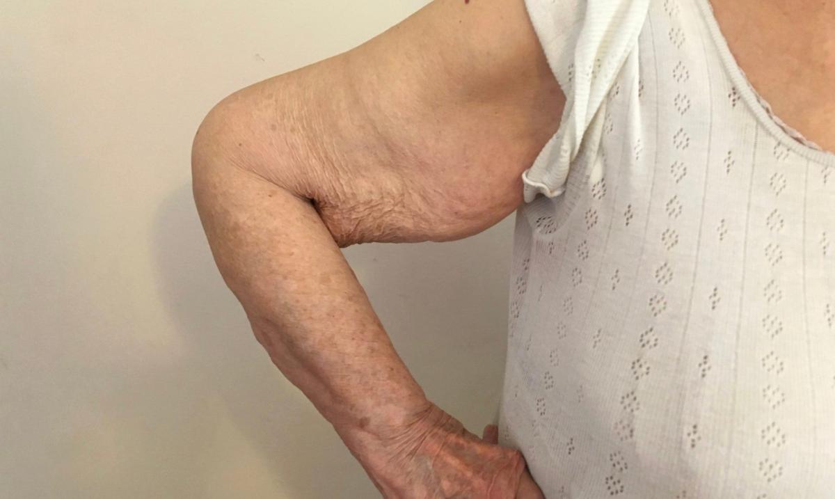 stigmiotypo othonis 2025 12 01 01.32.19