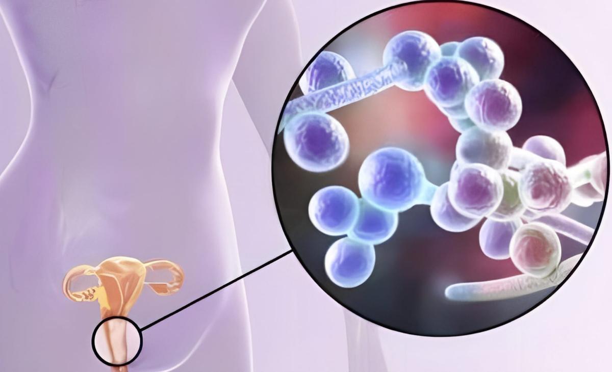 Όλα όσα πρέπει να ξέρετε για το υγρό που βγαίνει από 1 stigmiotypo othonis 2025 06 29 17.49.25