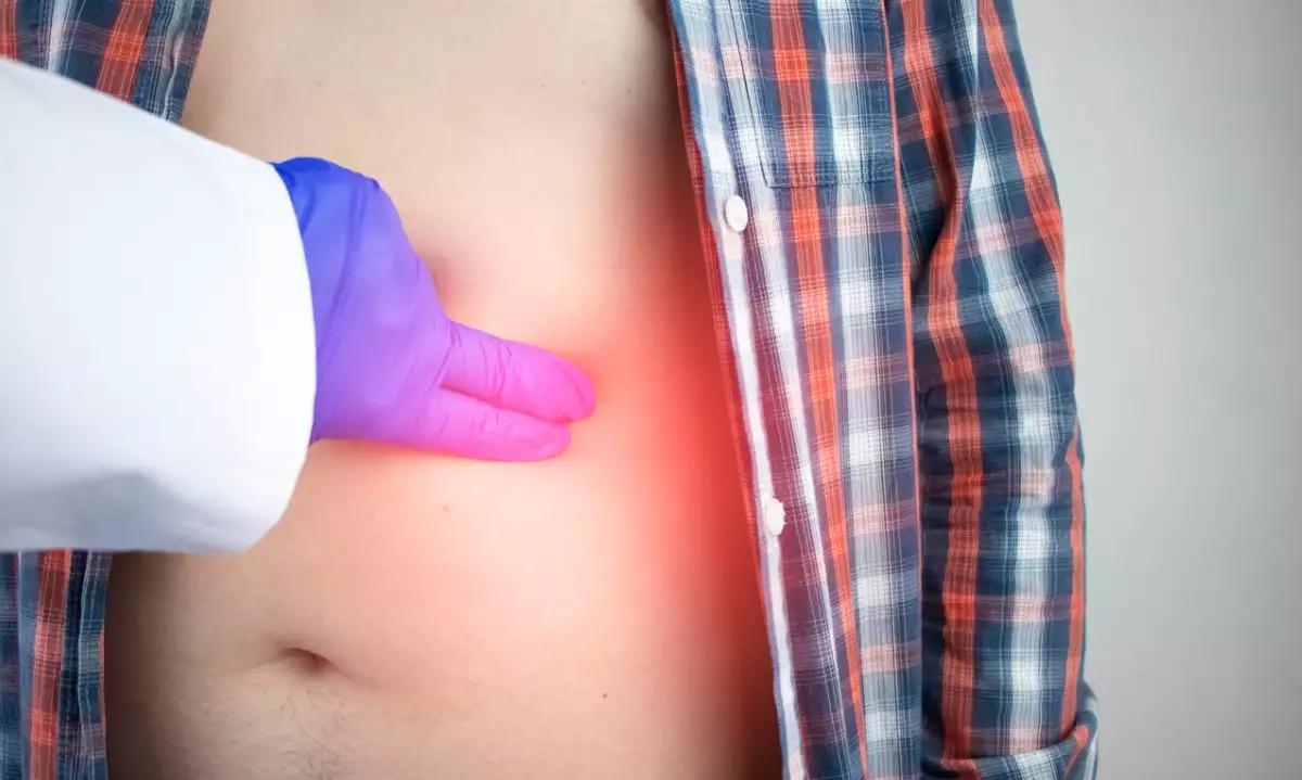 Σημάδια καρκίνου του παχέος εντέρου: Τα συμπτώματα που δεν πρέπει να αγνοήσετε 2 a man grabs his right side under the ribs pain in the liver pain syndrome in liver