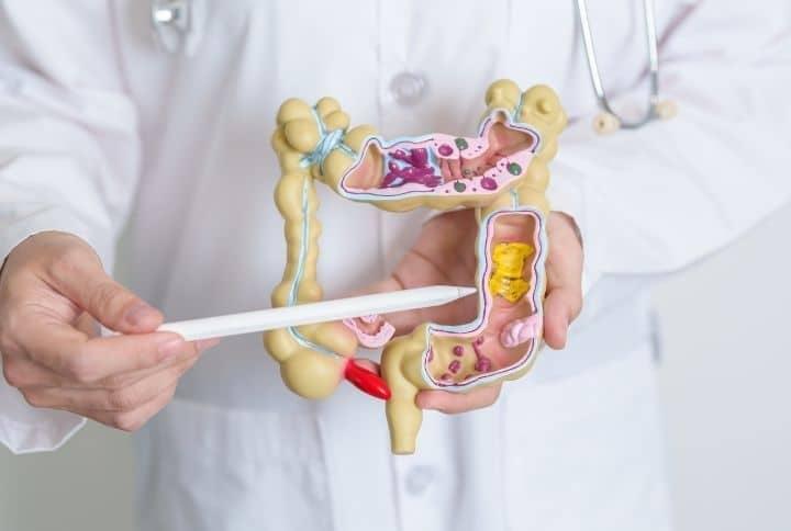 Σημάδια καρκίνου του παχέος εντέρου: Τα συμπτώματα που δεν πρέπει να αγνοήσετε 4 karkinos pacheos enteroy