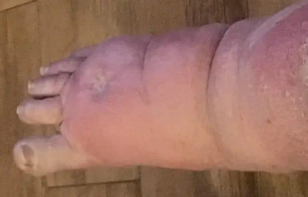 Απίστευτο 1