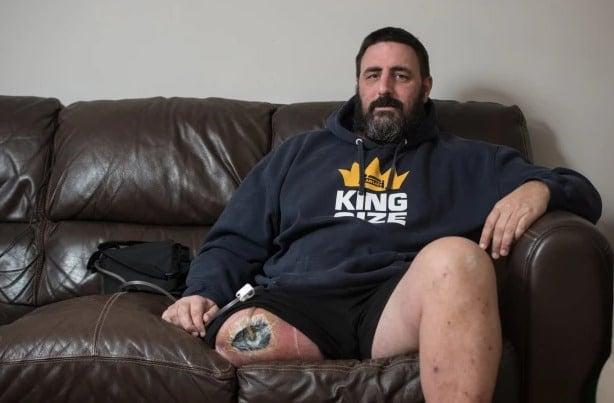 Απίστευτο 1