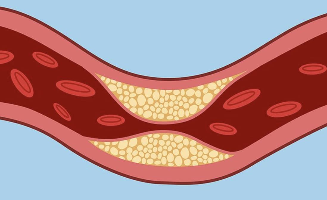 Γήρανση καρδιάς: 7 συμβουλές για να την επιβραδύνετε 3 stigmiotypo othonis 2025 12 06 17.36.29