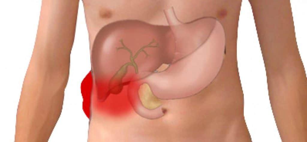 Λίπος στο συκώτι: Οι 4 χειρότερες τροφές για το λιπώδες ήπαρ, σύμφωνα με ηπατολόγο 1 sikoti aftodioikisi