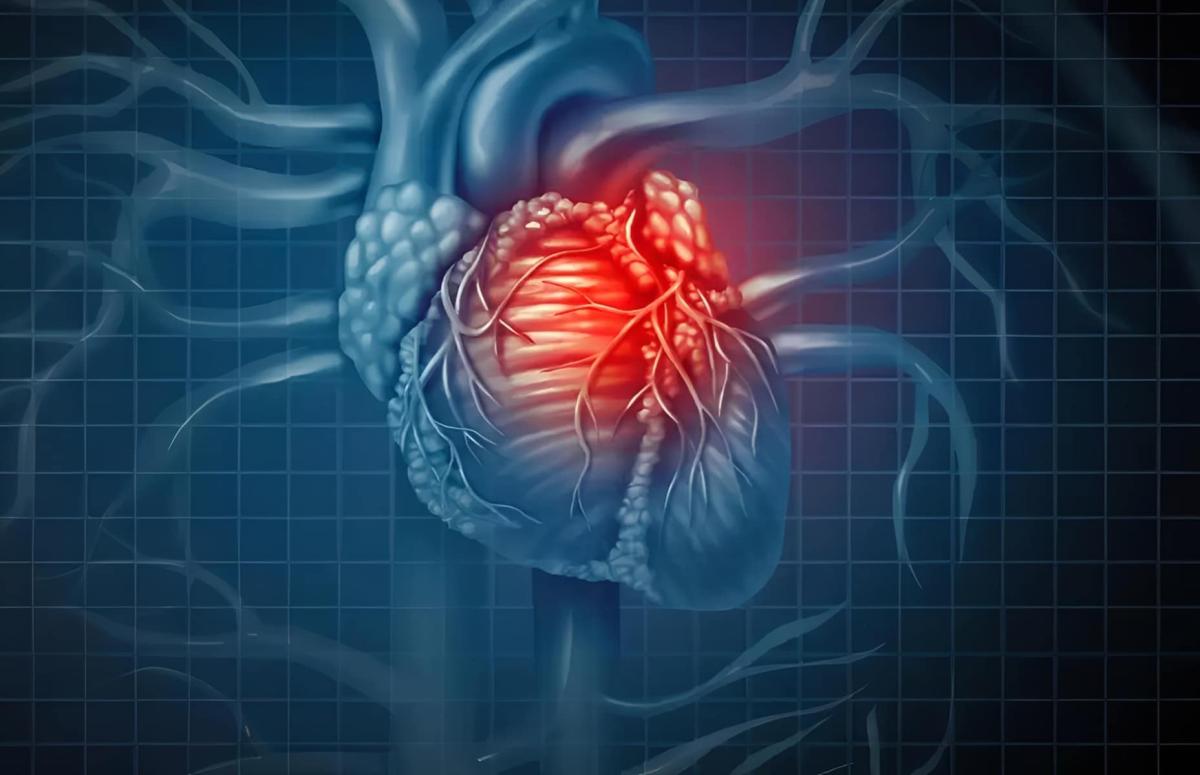 Πώς να επιβιώσετε μόνοι σας από καρδιακή προσβολή μετά τα 60 1 1 33