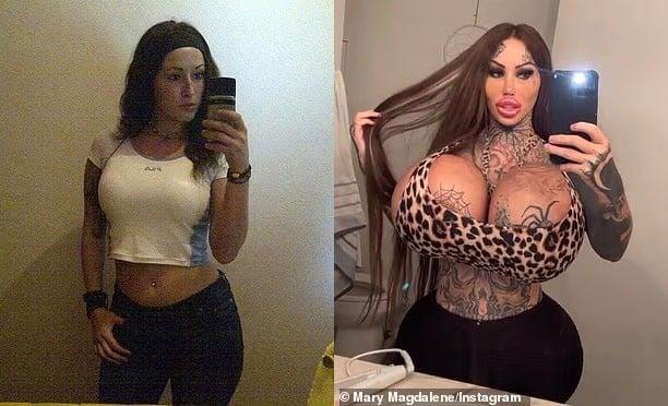 Εθισμένη στις πλαστικές επεμβάσεις 33χρονη έπεσε από τον 9ο όροφο ξενοδοχείου - Η μυστηριώδης τελευταία ανάρτησή της 3 12 2