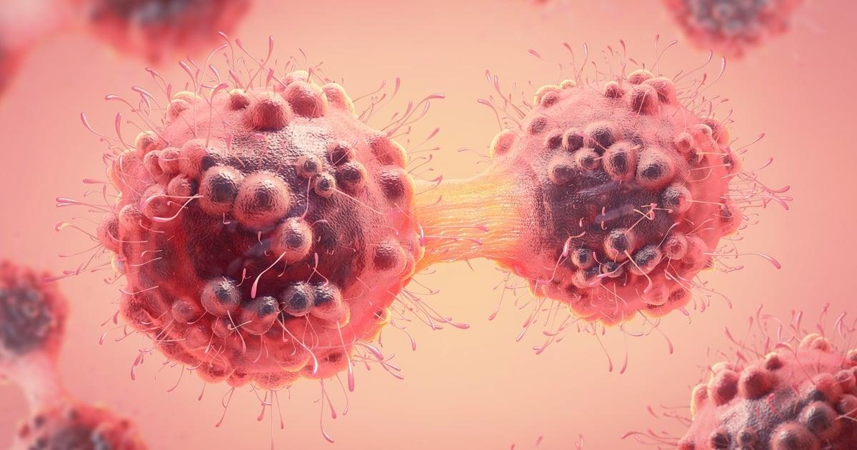 Το ανεπαίσθητο σύμπτωμα του καρκίνου που φαίνεται σε σεντόνια και μαξιλάρια κάθε πρωί 1 04 blog cancer cells l