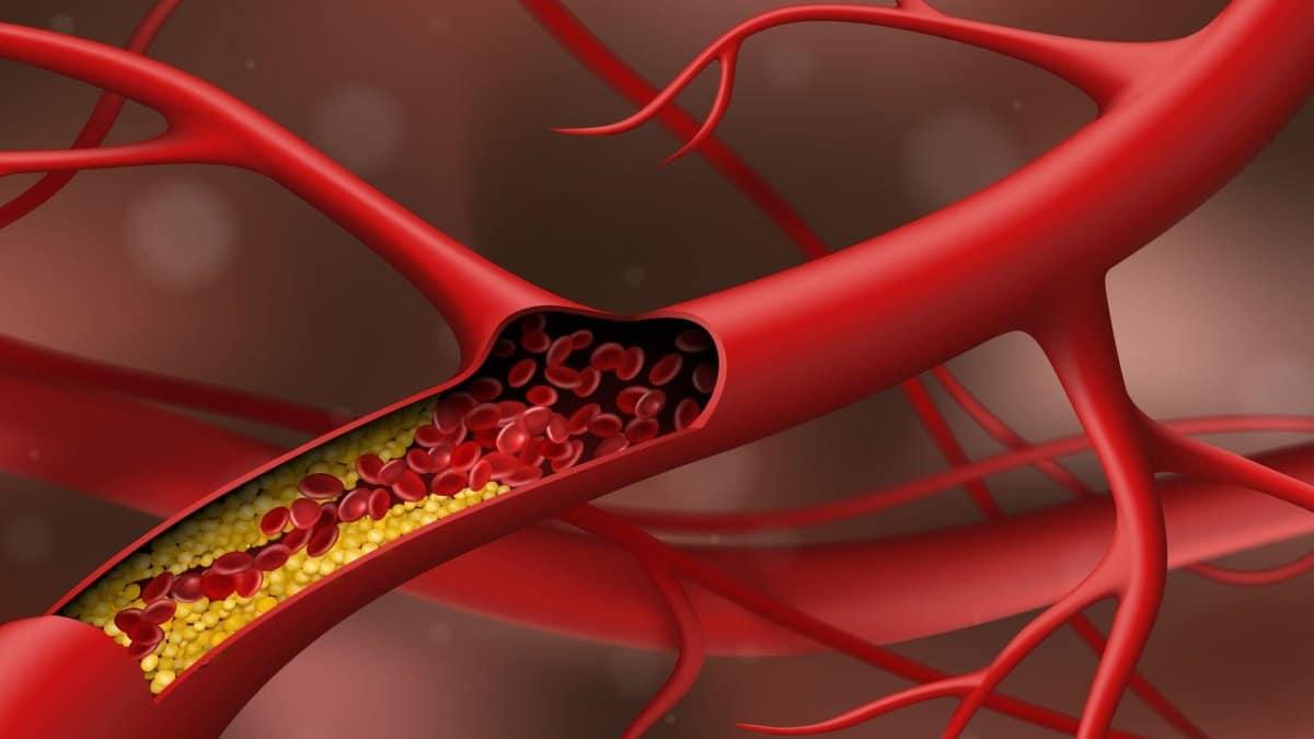 23052b63 cholisterini