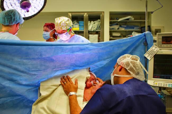 3 πράγματα που όλοι μας πρέπει να ξέρουμε για τις γυναίκες που έχουν κάνει καισαρική 2 skin to skin csection 2