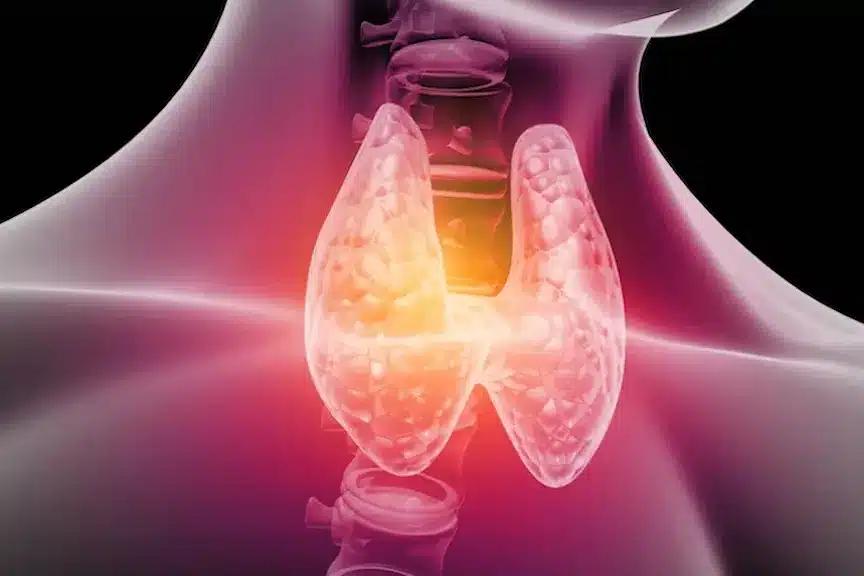 managing hashimotos disease holi