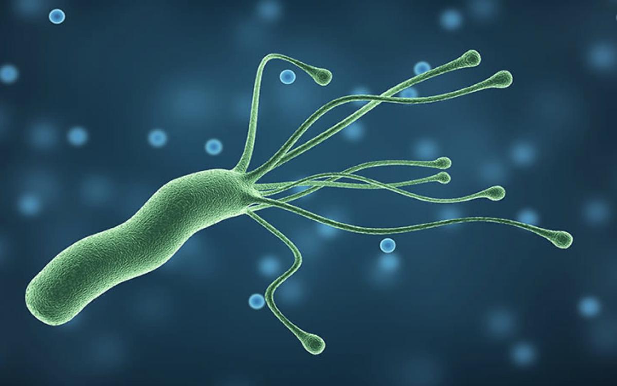 Πώς να απαλλαγείτε από το βακτήριο που ευθύνεται για την καούρα και το φούσκωμα 5 stigmiotypo othonis 2025 10 12 03.04.13