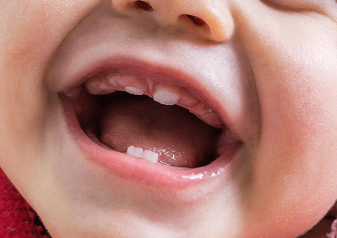 neogila dontai 1160x820 1